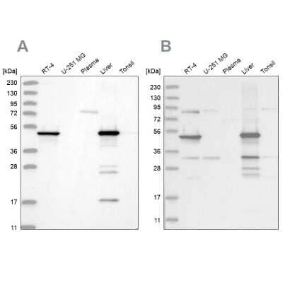 Western Blot: HMGCS2 Antibody [NBP2-33908]