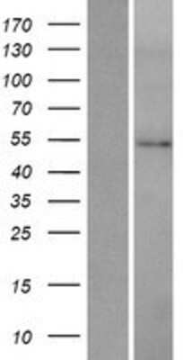 Western Blot: HMGCS2 Overexpression Lysate [NBP2-07739]