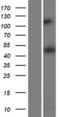 Western Blot: HMGCS2 Overexpression Lysate [NBP2-10151]