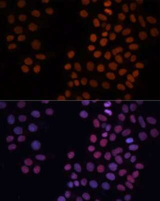 Immunocytochemistry/ Immunofluorescence: HMGN1/HMG14 Antibody - BSA Free [NBP3-02946]