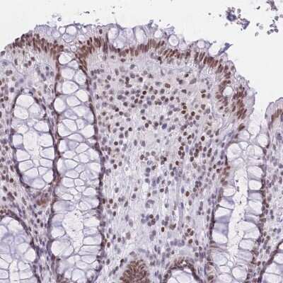 Immunohistochemistry-Paraffin: HMGN1/HMG14 Antibody [NBP2-47433]