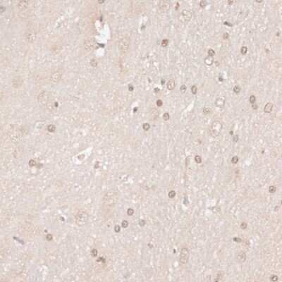 Immunohistochemistry-Paraffin: HMGN1/HMG14 Antibody - BSA Free [NBP3-03219]