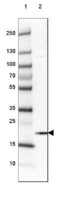 Western Blot: HMGN1/HMG14 Antibody [NBP2-47433]