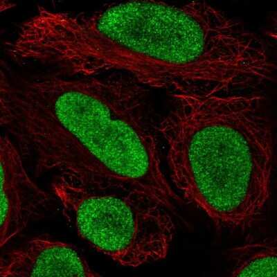 Immunocytochemistry/ Immunofluorescence: NHC Antibody [NBP2-57801]