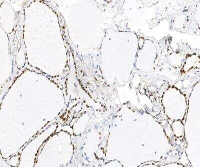 Immunohistochemistry-Paraffin: HMGN2 Antibody [NBP3-12793]