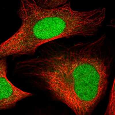 Immunocytochemistry/ Immunofluorescence: HMGN3/TRIP7 Antibody [NBP1-86904]