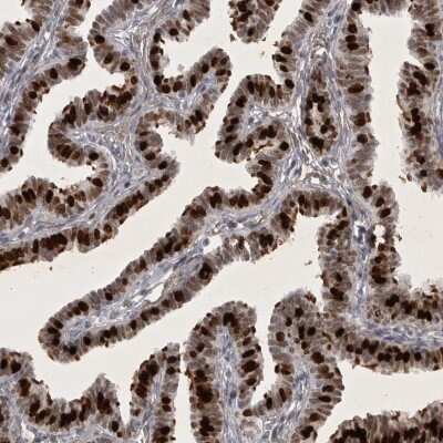 Immunohistochemistry-Paraffin: HMGN3/TRIP7 Antibody [NBP1-86904]