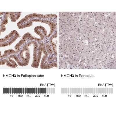 Immunohistochemistry-Paraffin: HMGN3/TRIP7 Antibody [NBP2-62640]