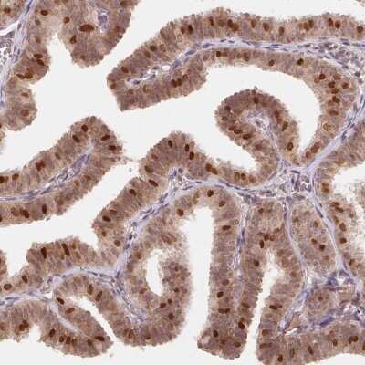 Immunohistochemistry-Paraffin: HMGN3/TRIP7 Antibody [NBP2-62640]