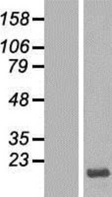 Western Blot: HMGN3/TRIP7 Overexpression Lysate [NBP2-10576]