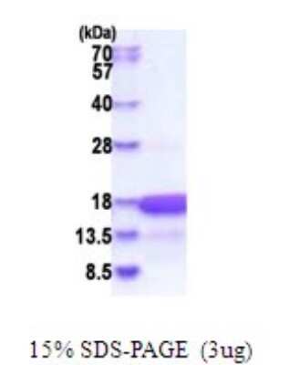 SDS-PAGE: Recombinant Human HMGN3/TRIP7 His Protein [NBP2-51809]