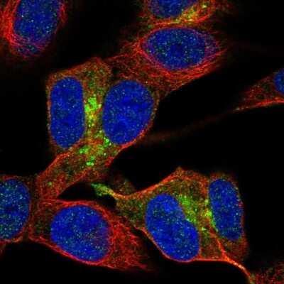 Immunocytochemistry/ Immunofluorescence: HMP19 Antibody [NBP2-49217]