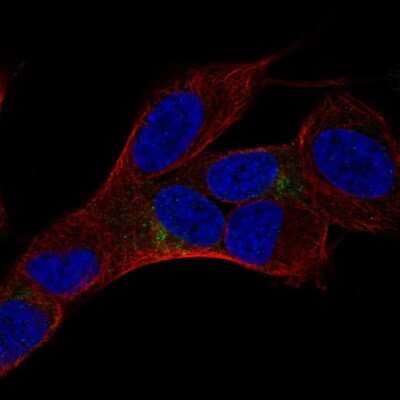 Immunocytochemistry/ Immunofluorescence: HMP19 Antibody [NBP2-68670]