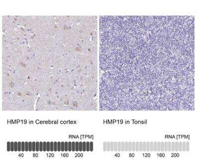 Immunohistochemistry-Paraffin: HMP19 Antibody [NBP2-49217]