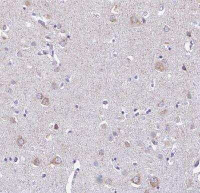Immunohistochemistry-Paraffin: HMP19 Antibody [NBP2-49217]
