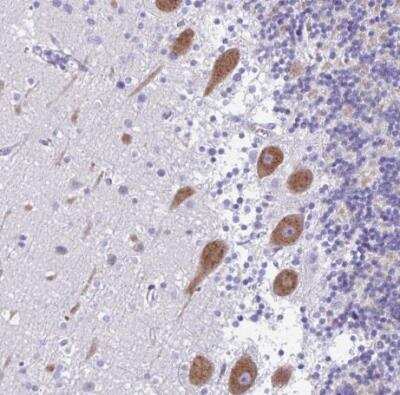 Immunohistochemistry-Paraffin: HMP19 Antibody [NBP2-49217]