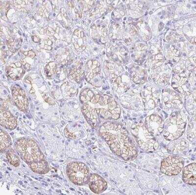 Immunohistochemistry-Paraffin: HMP19 Antibody [NBP2-49217]