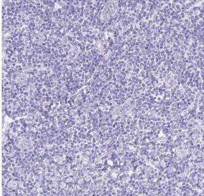 Immunohistochemistry-Paraffin: HMP19 Antibody [NBP2-49217]