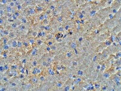 Immunohistochemistry-Paraffin: HMP19 Antibody [NBP3-12315]