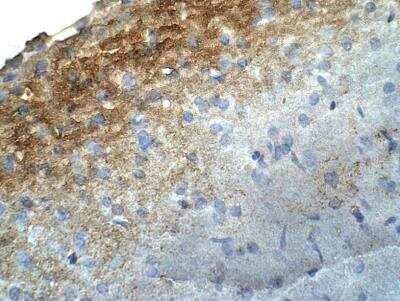 Immunohistochemistry-Paraffin: HMP19 Antibody [NBP3-12315]