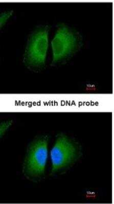 Immunocytochemistry/ Immunofluorescence: HMW Kininogen Antibody [NBP1-31340]