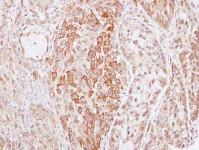 Immunohistochemistry-Paraffin: HMW Kininogen Antibody [NBP1-31340]
