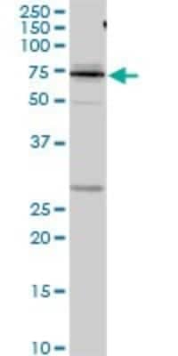 Western Blot: Kininogen Antibody [H00003827-D01P]