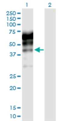 Western Blot: Kininogen Antibody [H00003827-D01P]
