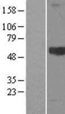 Western Blot: Kininogen Overexpression Lysate [NBL1-12368]