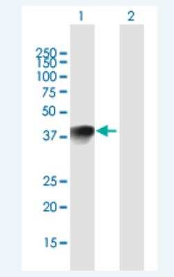 Western Blot: HMX1 Antibody [H00003166-B01P-50ug]