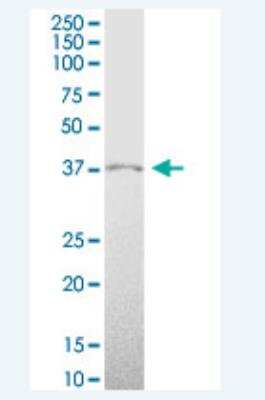 Western Blot: HMX1 Antibody [H00003166-B01P-50ug]