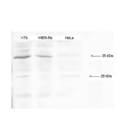 Western Blot: HMX1 Antibody [NBP2-84070]