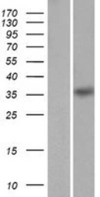 Western Blot: HMX1 Overexpression Lysate [NBP2-06757]