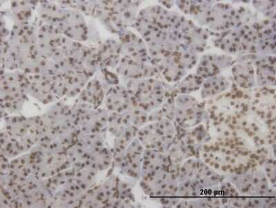 Immunohistochemistry-Paraffin: HMX2 Antibody (1B10) [H00003167-M07]