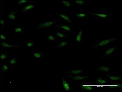 Immunocytochemistry/ Immunofluorescence: HMX2 Antibody (1D7) [H00003167-M08]