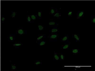 Immunocytochemistry/ Immunofluorescence: HMX2 Antibody (2D2) [H00003167-M09]