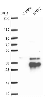 Western Blot: HMX2 Antibody [NBP1-91997]