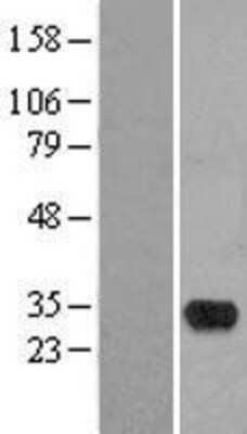 Western Blot: HMX2 Overexpression Lysate [NBL1-11627]