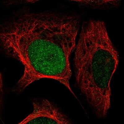 Immunocytochemistry/ Immunofluorescence: HMX3 Antibody [NBP2-57441]