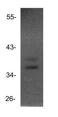 Western Blot: HMX3 Antibody [NBP1-69011]