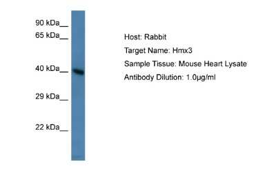 Western Blot: HMX3 Antibody [NBP2-85051]