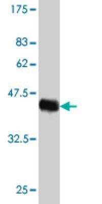 Western Blot: HN1 Antibody (2C8) [H00051155-M01]