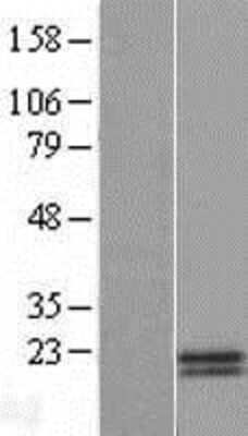 Western Blot: HN1 Overexpression Lysate [NBP2-08945]