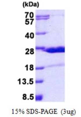 SDS-PAGE: Recombinant Human HN1 His Protein [NBP2-23106]