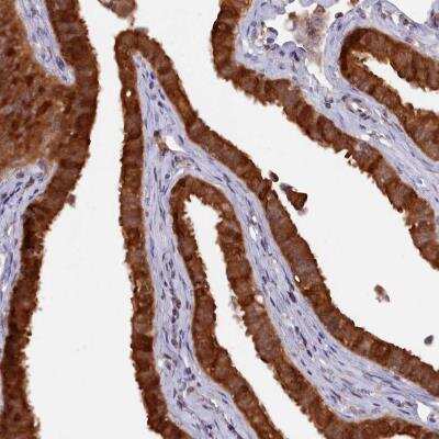 Immunohistochemistry-Paraffin: HN1L Antibody [NBP1-88446]