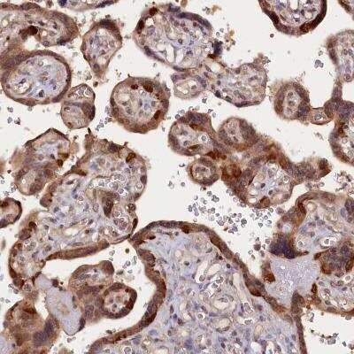 Immunohistochemistry-Paraffin: HN1L Antibody [NBP1-88446]