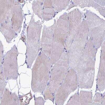 Immunohistochemistry-Paraffin: HN1L Antibody [NBP1-88446]