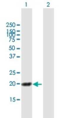 Western Blot: HN1L Antibody [H00090861-B01P]