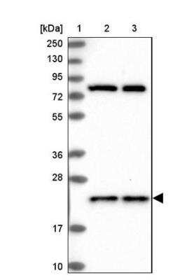 Western Blot: HN1L Antibody [NBP1-88445]