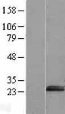 Western Blot: HN1L Overexpression Lysate [NBL1-11629]